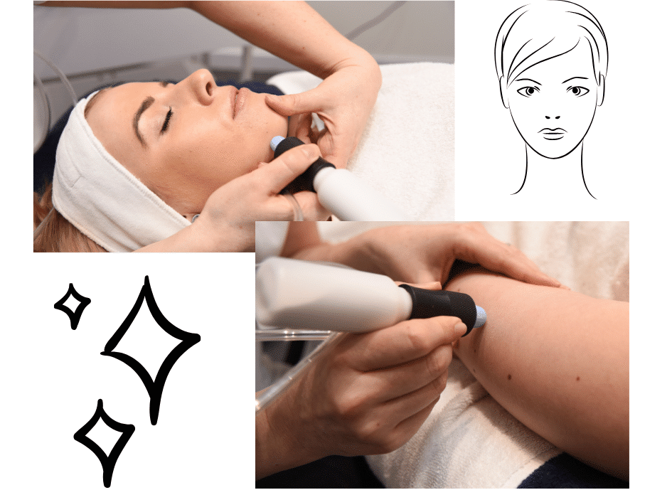 Microdermabrasion
